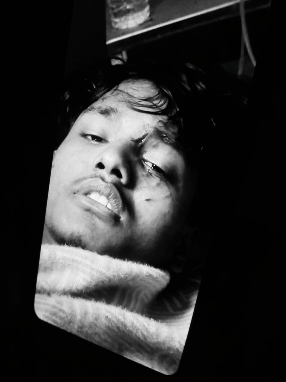 कलैया–४ मा फिल्मी स्टाइलमा पूर्व वडाध्यक्षका छोरा ओमप्रकाश सहनीमाथि चक्कु प्रहार,अवस्था गम्भीर 