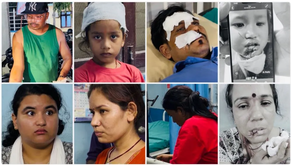 बारामा दर्जनौं स्थानीयलाई टोक्ने कुकुर नियन्त्रणमा, समात्ने क्रममा जीतपुरसिमरा-२ का वडाध्यक्ष घाइते
